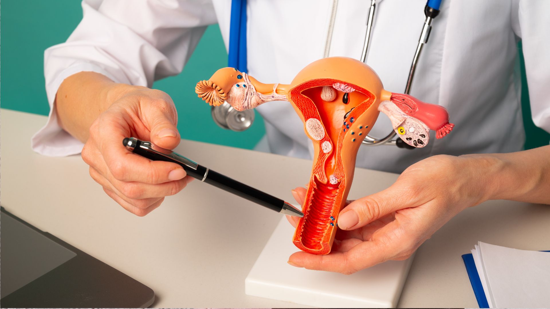 Apakah Perimenopause bisa di cegah?